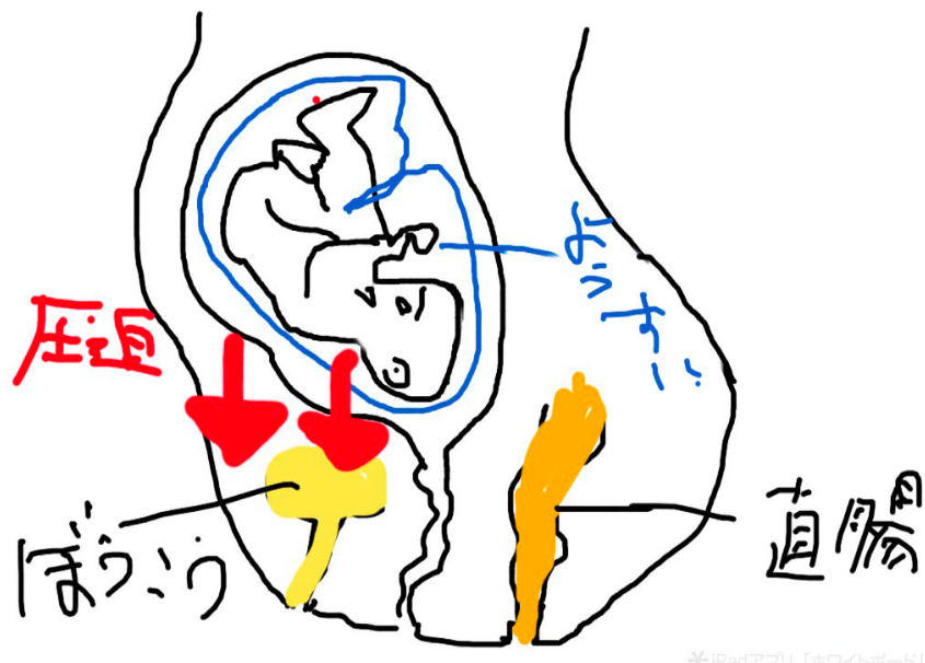 妊娠期の尿モレの原因